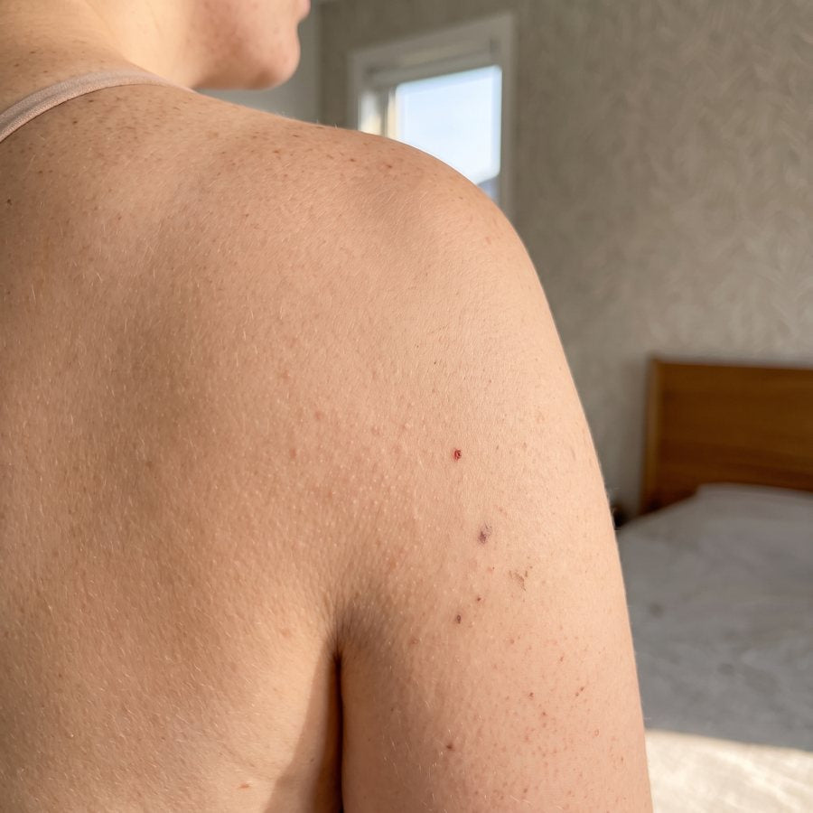 After
