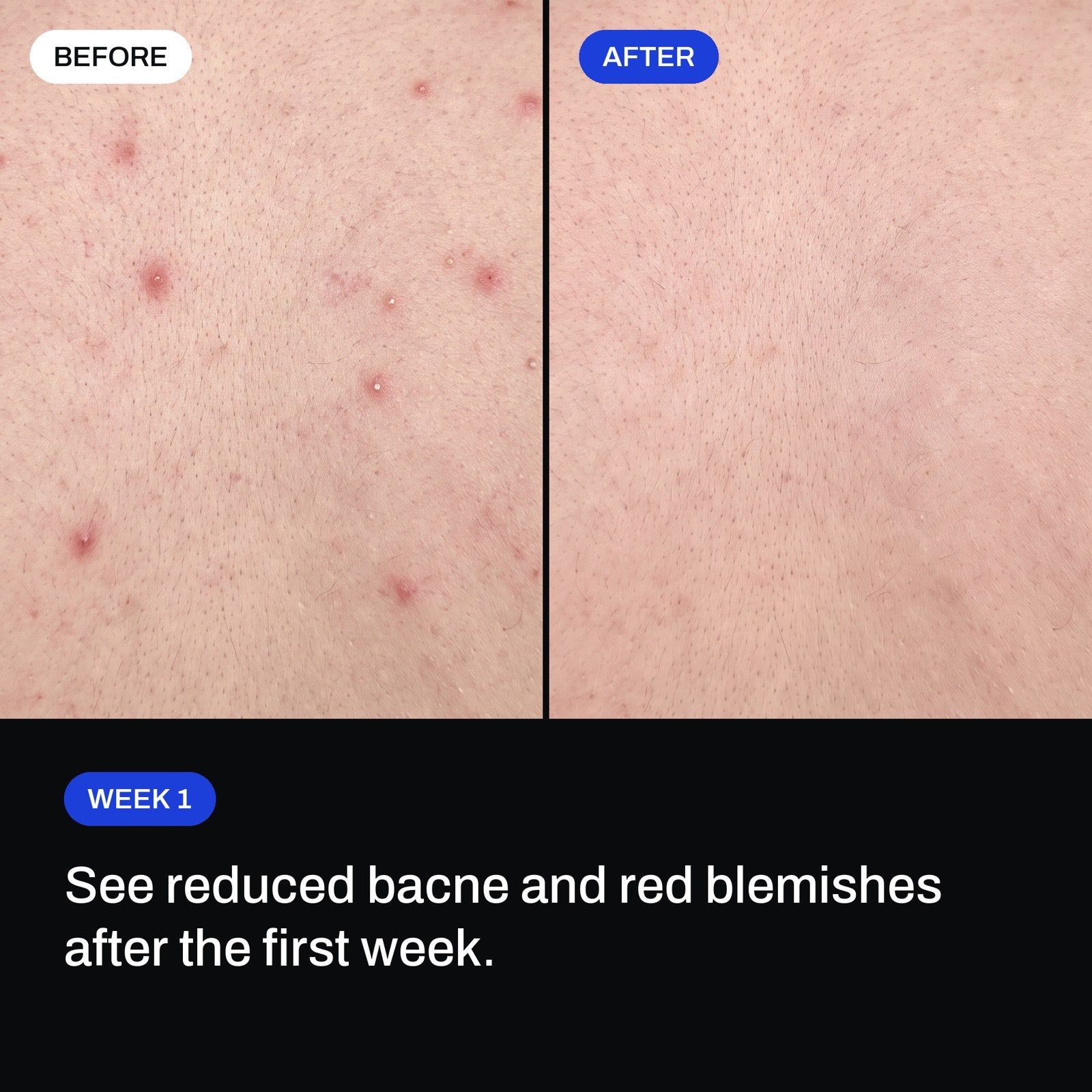 Before and after: visible skin improvements after the first week
